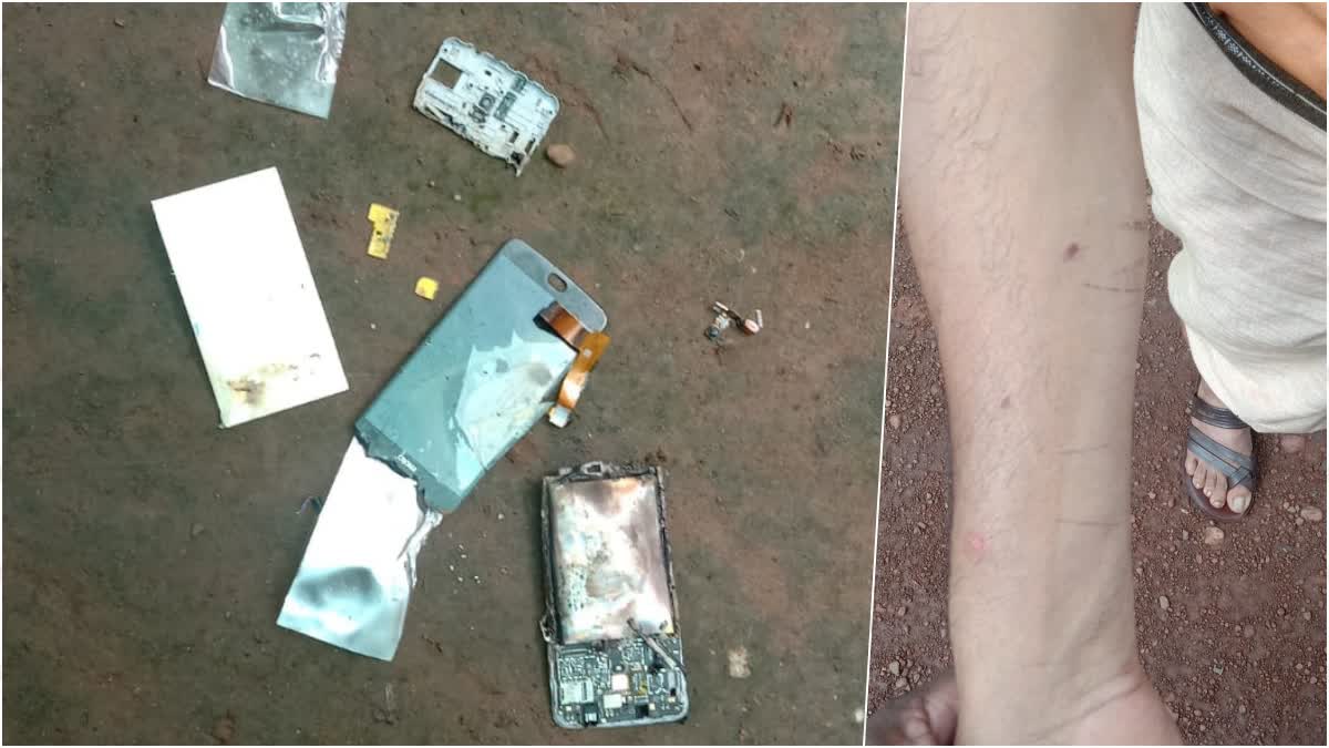 mobile phone blast  mobile phone exploded  മൊബൈൽ ഫോൺ പൊട്ടിത്തെറിച്ചു  പൊള്ളലേറ്റു  burnt  അപകടം  phone owner got burnt  പൊട്ടിത്തെറിച്ചു  accident  mobile phone  exploded  blast  ഫോണ്‍ ഉടമയ്ക്ക് പൊള്ളലേറ്റു  അപകട സാധ്യതകള്‍  Hazards