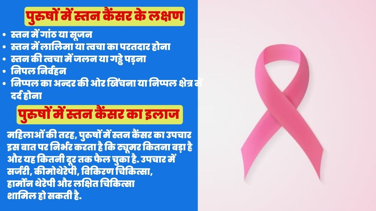 Breast Cancer In Men