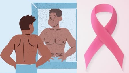 Breast Cancer In Men