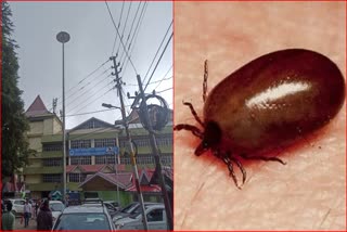 Scrub Typhus Case In IGMC shimla