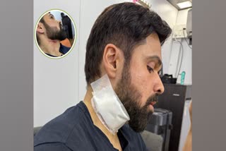 Emraan Hashmi injured