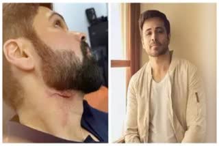 EMRAAN HASHMI  ACCIDENT IN GOODACHARI 2 SET  ഇമ്രാൻ ഹാഷ്‌മിക്ക് പരിക്ക്  ഗൂഡാചാരി 2 സെറ്റിൽ അപകടം