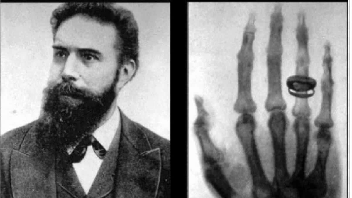 Wilhelm Rontgen X-ray collage
