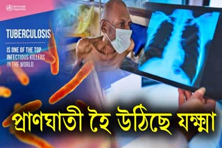 Why is TB spreading rapidly in the world despite treatment? the reasons revealed in the latest report of WHO