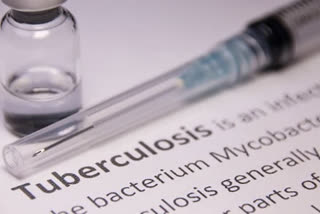 Record 7.5 mn people globally diagnosed with TB in 2022: WHO