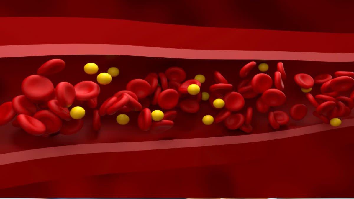 Which food is best for lowering cholesterol?