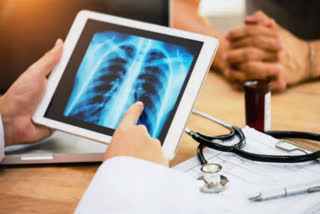 New AI tool can detect Covid infection from chest X-rays 98% accuracy