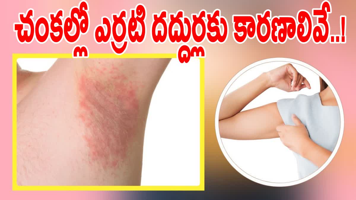 Armpit Rashes Causes