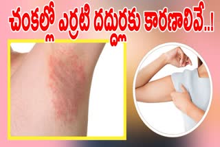 Armpit Rashes Causes