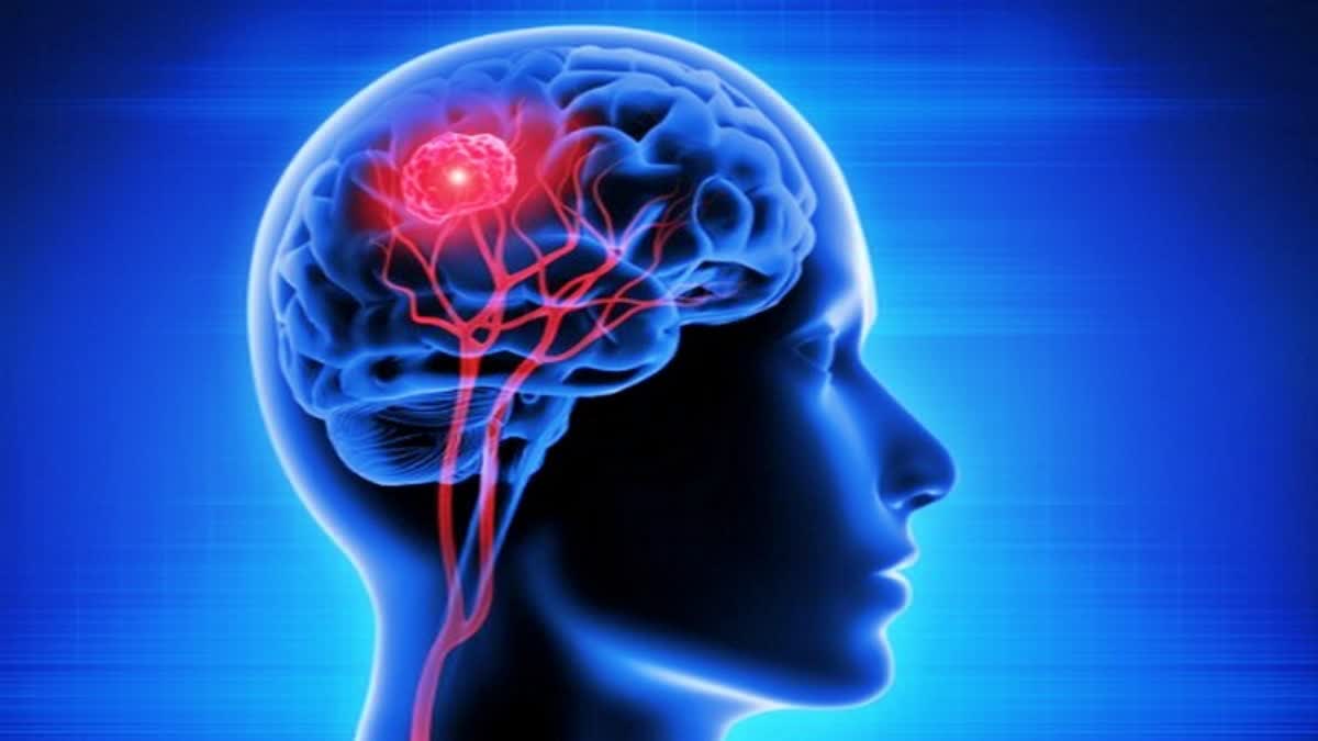 NEURO SURGERY