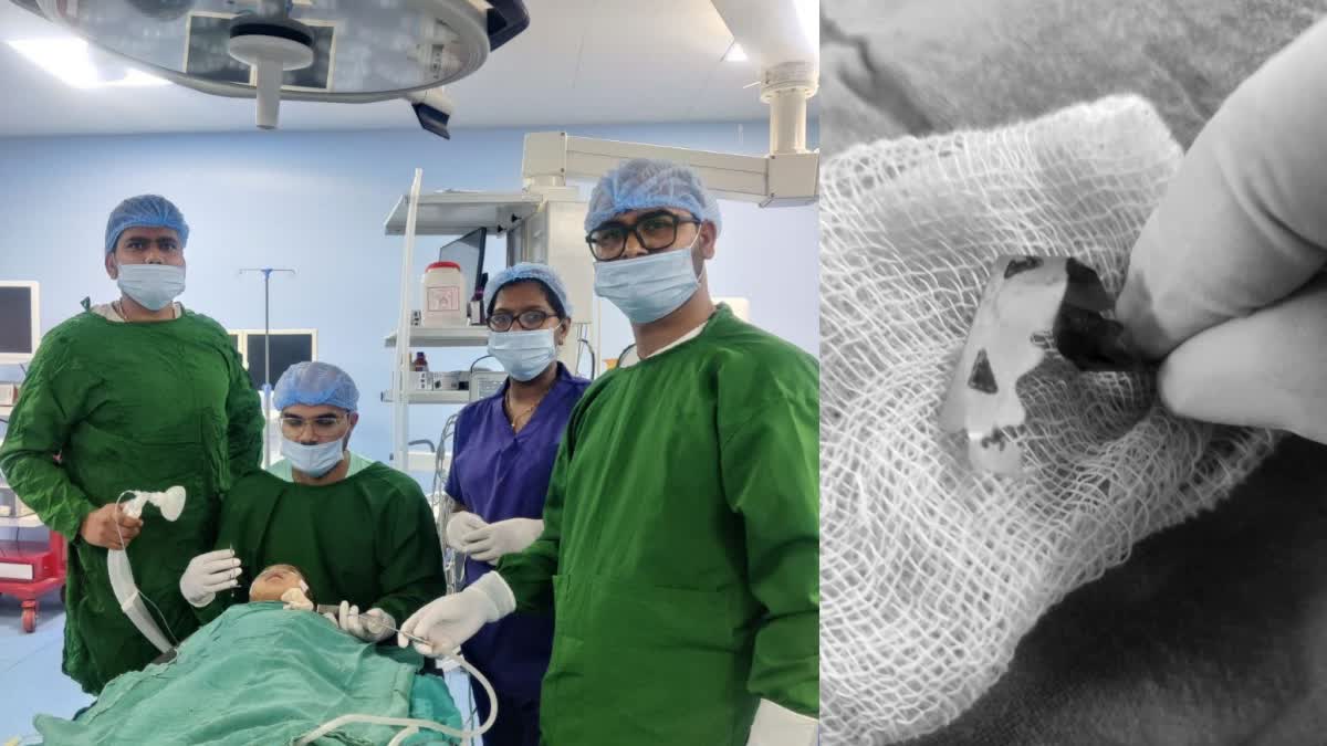 SHAHDOL DOCTORS TAKEN OUT BLADE  BLADE SWALLOWED BY CHILD IN MP  ബ്ലേഡ് വിഴുങ്ങി  ബ്ലേഡ് ശ്വാസനാളത്തിൽ കുടുങ്ങി