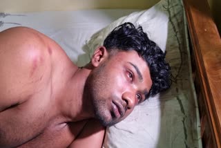 YOUTH ATTACKED IN THEVALAKKARA  തേവലക്കരയിൽ യുവാവിന് മർദനം  യുവാവിനെ കെട്ടിയിട്ട് മർദിച്ചു  MAN BEATEN BY GIRL FRIENDS FAMILY