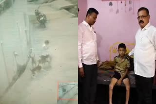 stray-dogs-attacked-boy-in-gadag-boy-seriously-injured