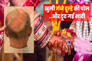 Groom Wearing Hair Wig In Banka