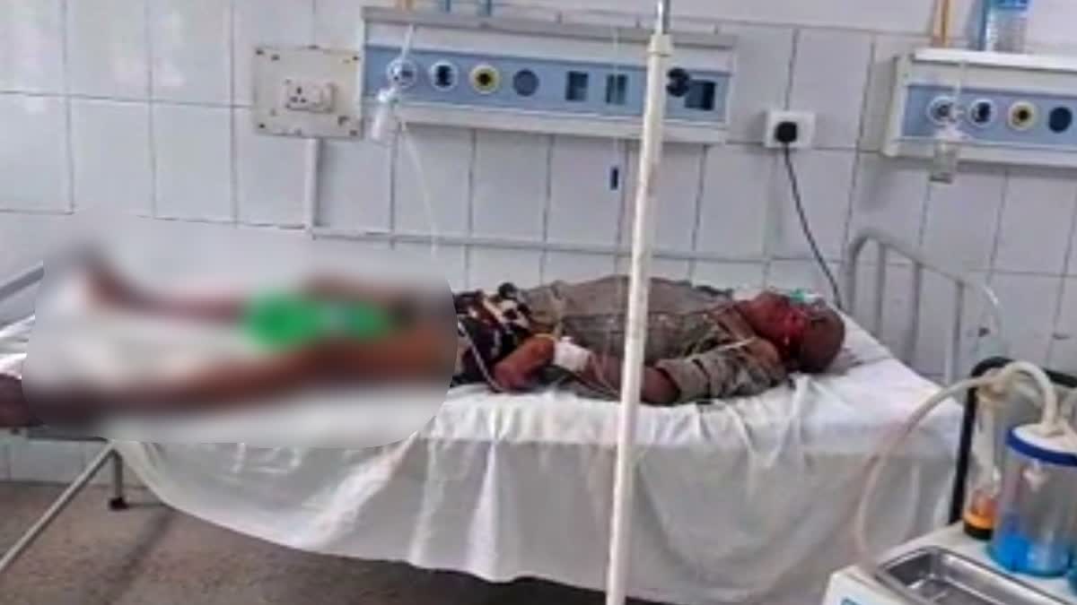 patient given cold drink bottle instead of urine bag In bihar Jamui Sadar Hospital