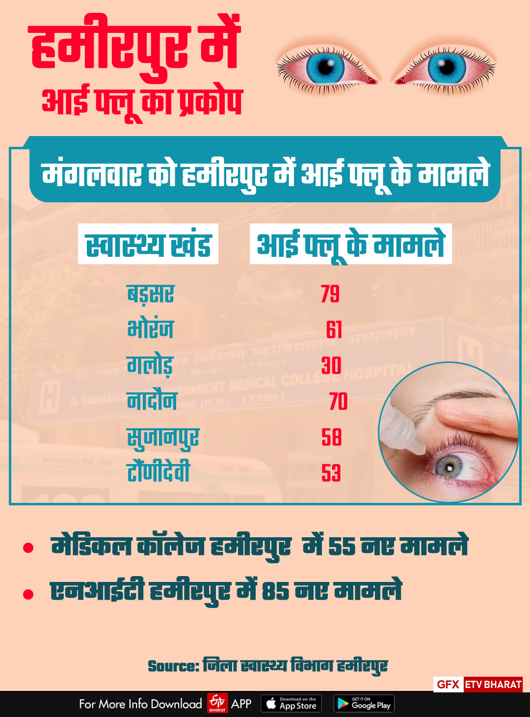 Eye Flu Cases in Hamirpur.