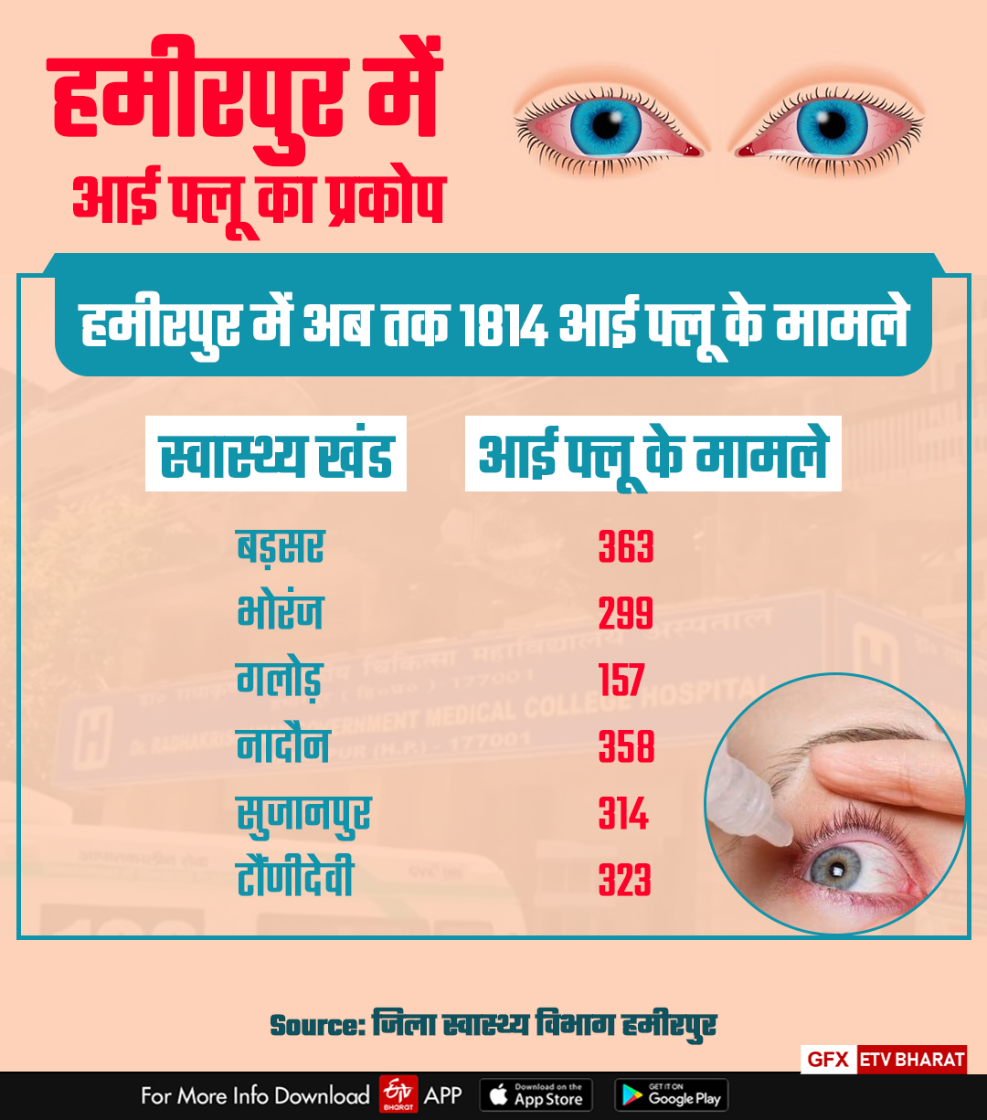 Eye Flu Cases in Hamirpur.