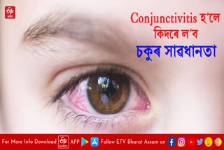 Conjunctivitis