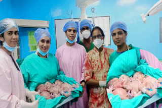 woman gave birth to 3 child