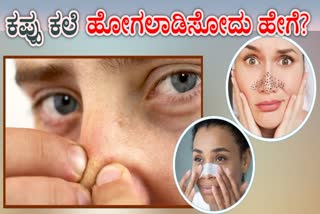 TIPS TO REMOVE BLACKHEADS  HOW TO GET RID OF BLACKHEADS  BLACKHEADS  BLACKHEADS REMOVE TIPS