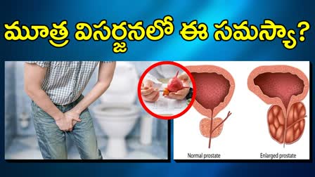 Effects of Prostate Enlargement