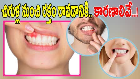 Bleeding Gums Causes