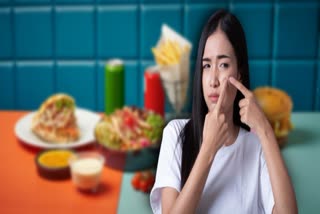 Avoid Food for Acne News