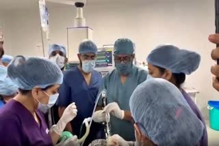 Corn piece stuck in lungs of Child removed through life saving surgery at ahmedabad civil hospital