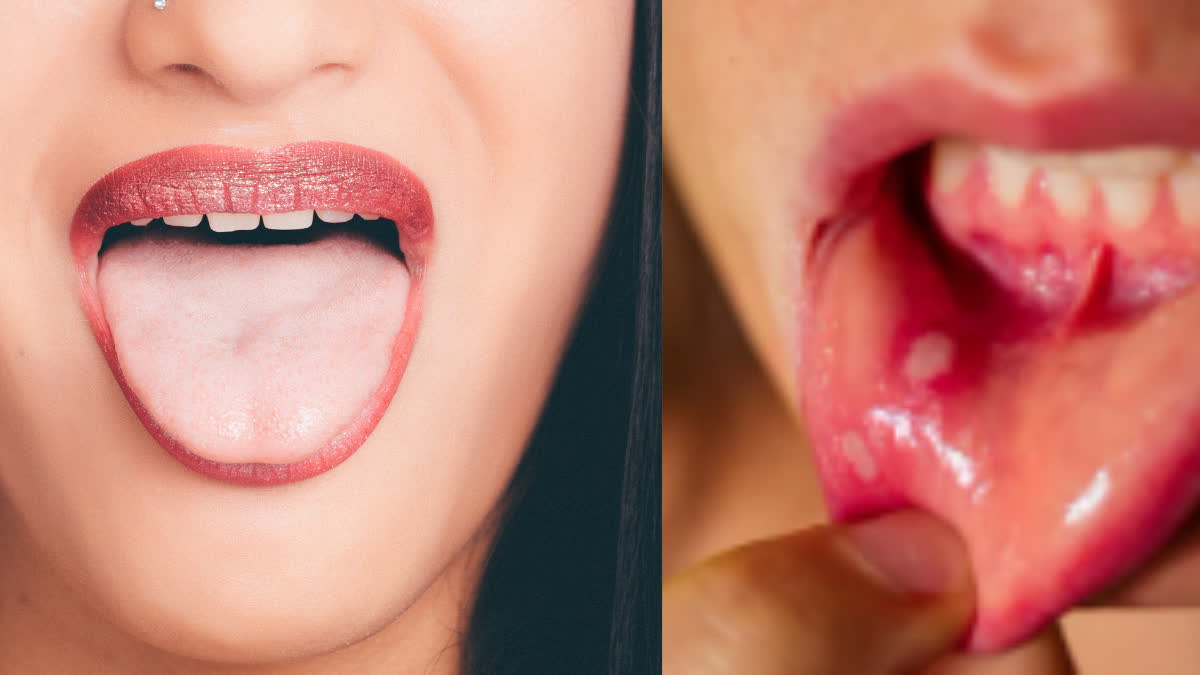 If you see these 8 signs in your body, understand that oral cancer has started