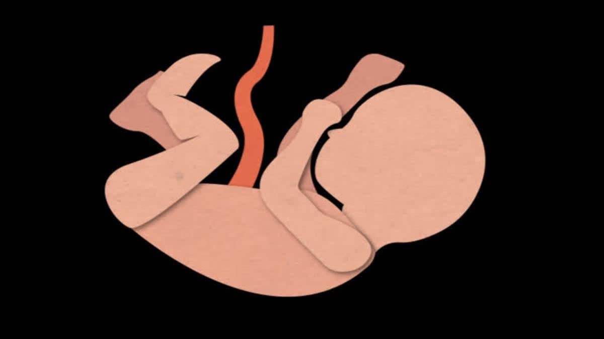 Bhopal Woman Delivers Four Babies
