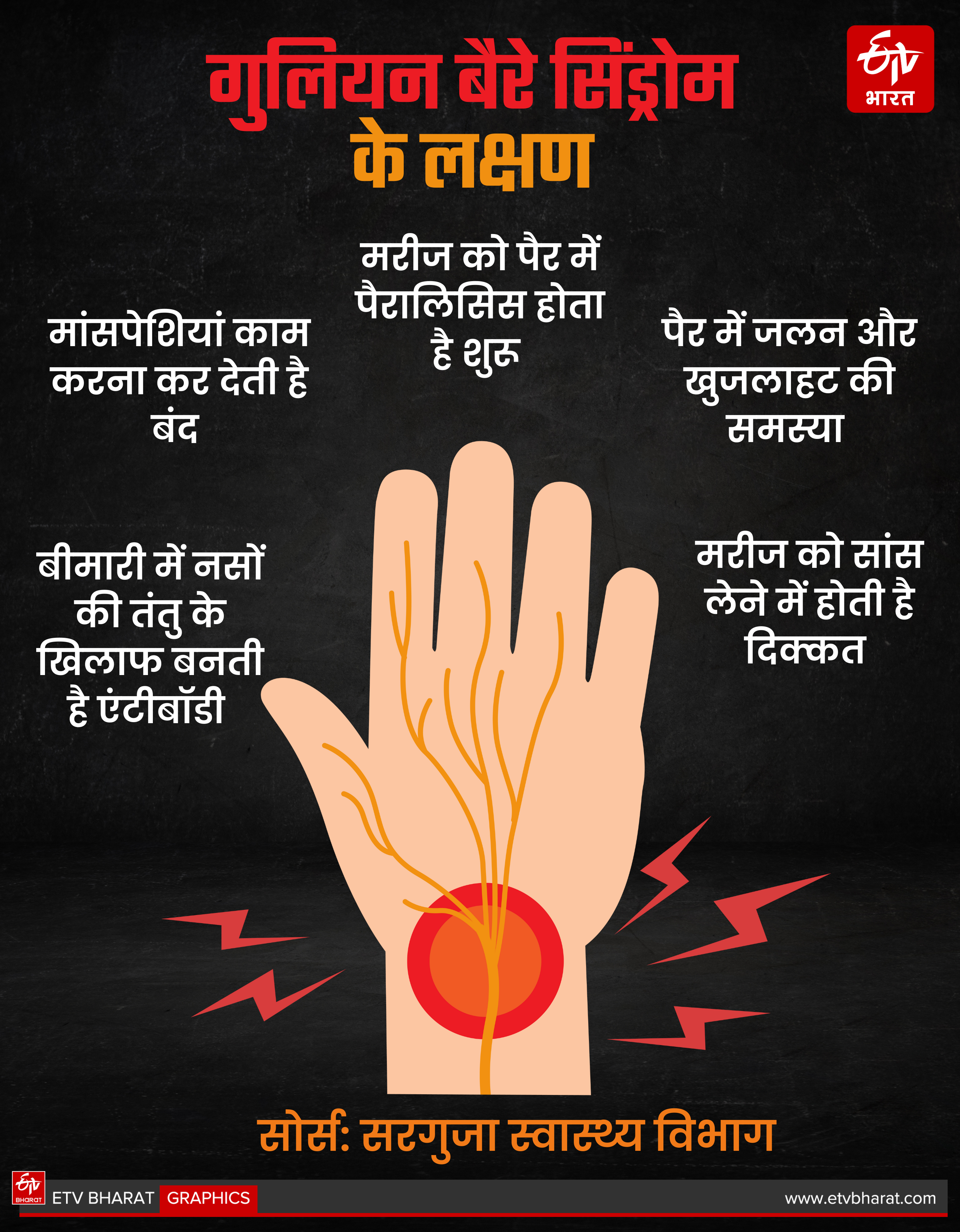 Symptoms Of Gullian Barre Syndrome