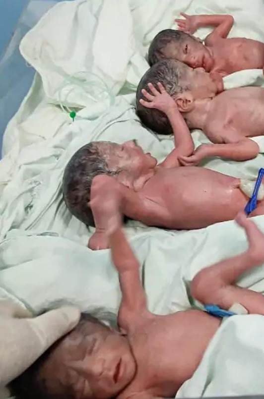 WOMAN BIRTH TO 4 CHILDREN