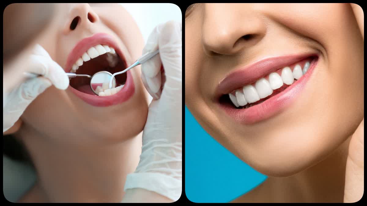 Teeth Care Tips