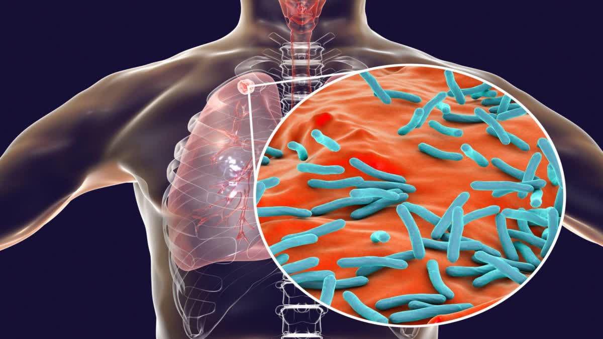 Never ignore a cough that lasts for more than a week, otherwise it can be fatal