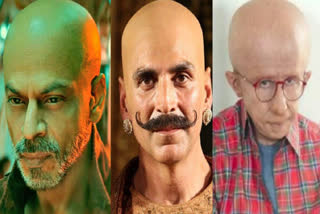 SRK BALD