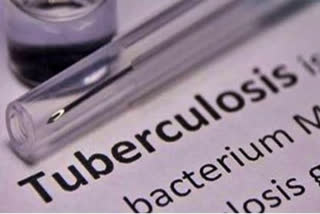 Prisoners in India 5 times more at risk of TB: Lancet study