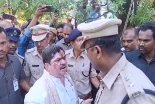 Police attack on Minister Ponnam photographer