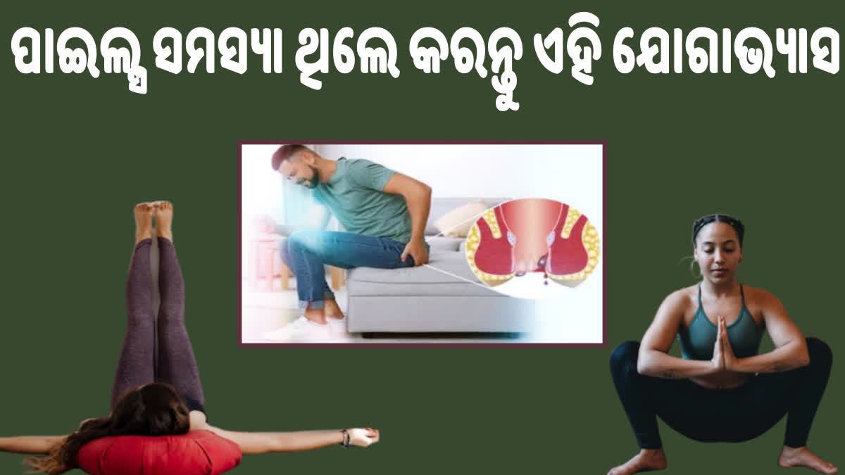 ପାଇଲ୍ସ ସମସ୍ୟାରେ ପୀଡ଼ିତ ରୋଗୀ ଆଭ୍ୟାସ କରନ୍ତୁ ଏହି ଯୋଗାଭ୍ୟାସ, ଯନ୍ତ୍ରଣାରୁ ମିଳିପାରେ ଆରାମ