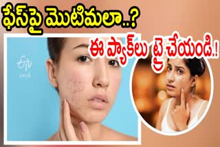 Home Remedies for Pimples and Dark Spots