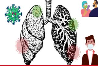 SARS COV 2 Virus