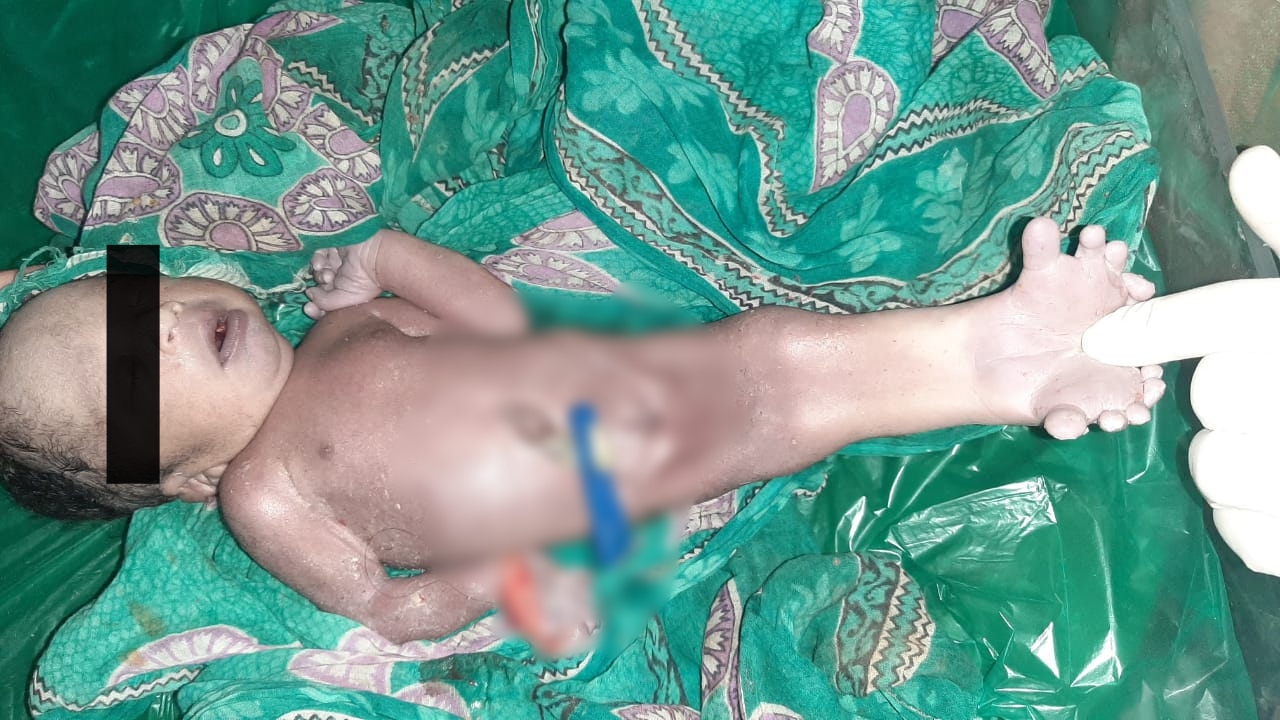 woman gave birth to a baby with a strange anatomy like fish