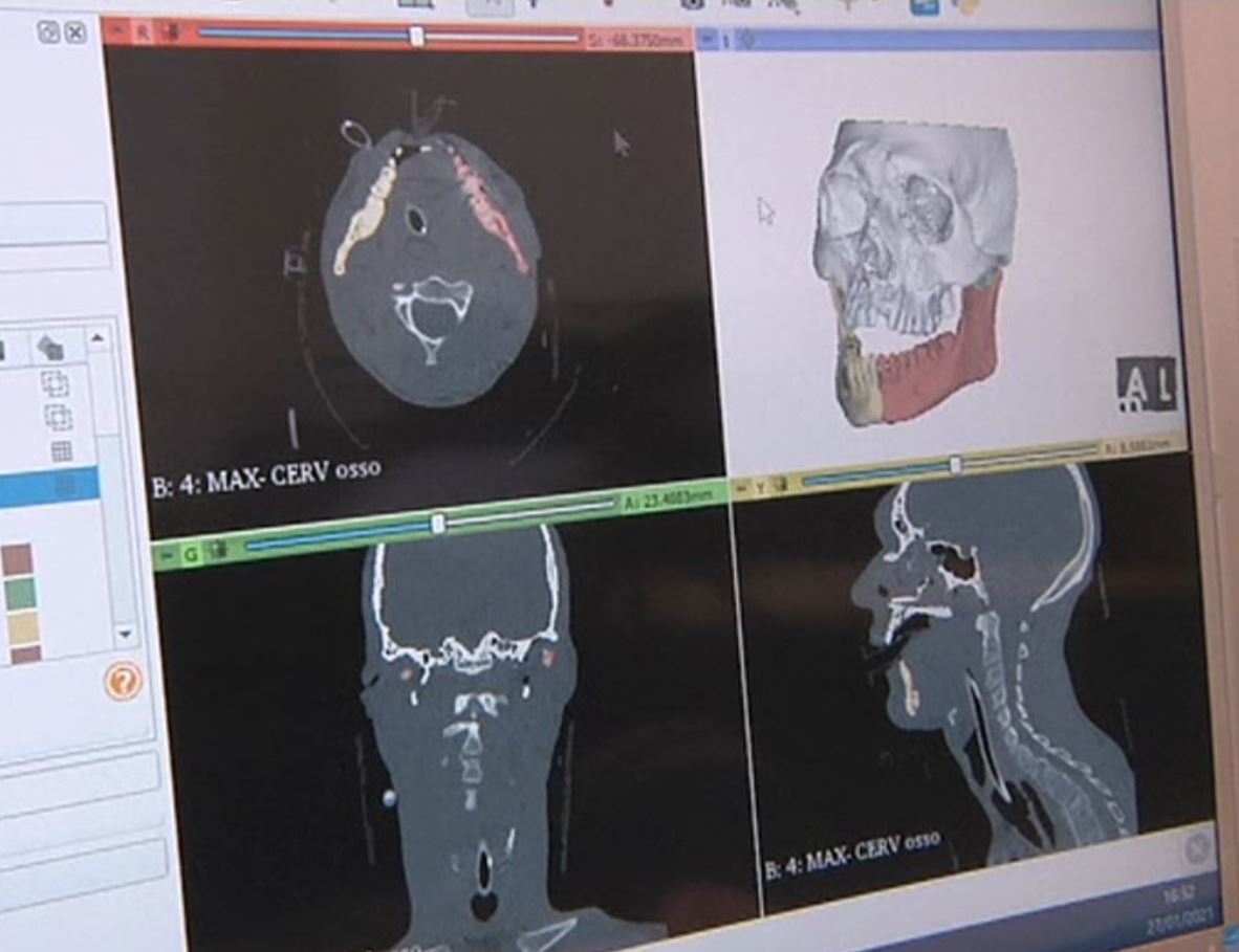 ITALY 3D FACE RECONSTRUCTION