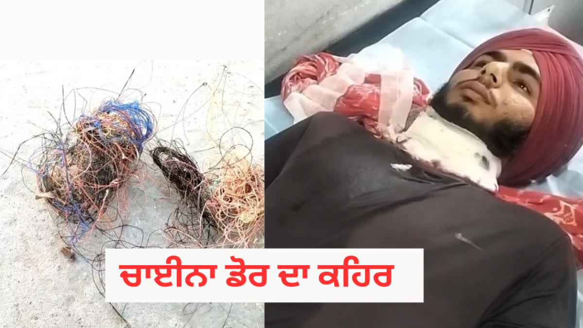 Another young man who became a victim of China Door, his cheek was cut while riding a motorcycle in barnala