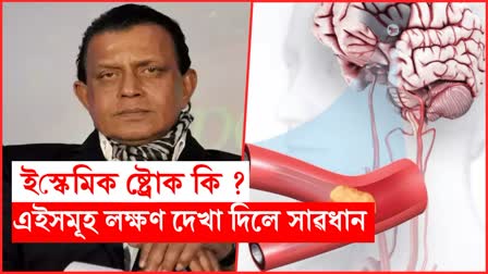 What is ischemic cerebrovascular stroke? All about the disease  Mithun Chakraborty diagnosed with