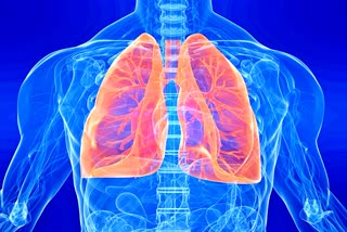 Lung cancer