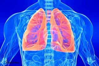 Lung Cancers Rise