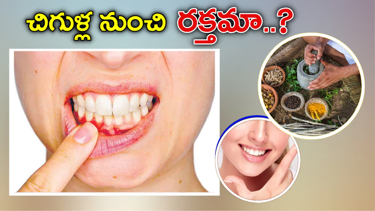 Gum Bleeding Treatment Ayurveda