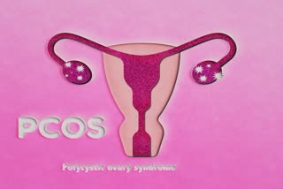 PCOS Effect Women News