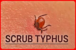 scrub typhus