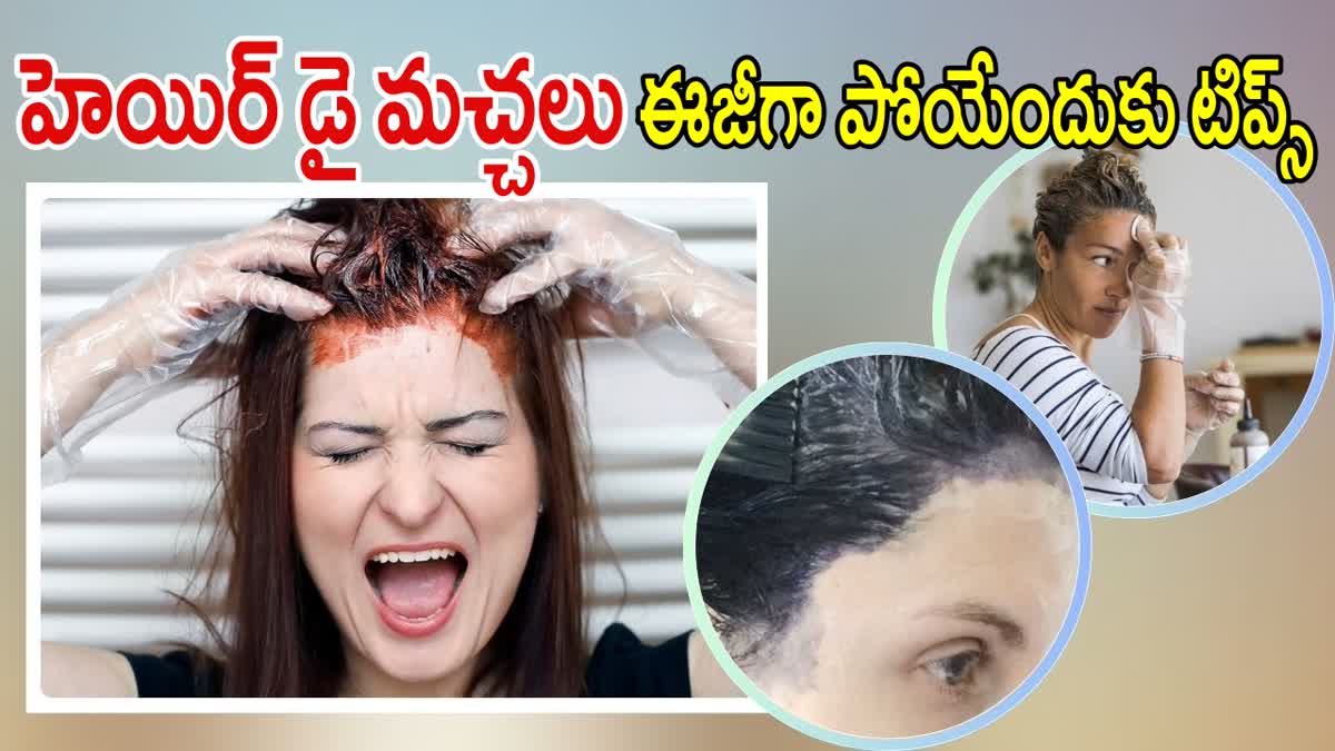 Hair Dye Stains Remove Tips